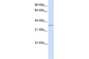 ALDOC antibody used at 1 ug/ml to detect target protein. (ALDOC 抗体  (C-Term))