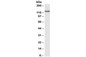 Western blot testing of HeLa lysate with OSMR antibody at 0. (Oncostatin M Receptor 抗体)