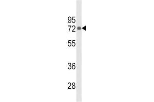 Western Blotting (WB) image for anti-Phosphatidylinositol-4-Phosphate 5-Kinase, Type I, gamma (PIP5K1C) antibody (ABIN3003648) (PIP5K1C 抗体)