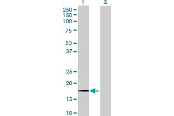 Riboflavin Kinase 抗体  (AA 1-162)