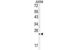 Western Blotting (WB) image for anti-MOB1, Mps One Binder Kinase Activator-Like 1B (MOBKL1B) antibody (ABIN3003175) (MOB1A 抗体)