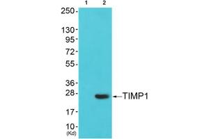 Western blot analysis of extracts from cos-7 cells (Lane 2), using TIMP1 Antibody. (TIMP1 抗体  (Internal Region))