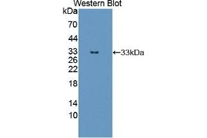 Detection of Recombinant ErbB3, Human using Polyclonal Antibody to V-Erb B2 Erythroblastic Leukemia Viral Oncogene Homolog 3 (ErbB3) (ERBB3 抗体  (AA 709-966))