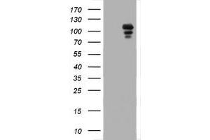 Image no. 1 for anti-Progesterone Receptor (PGR) antibody (ABIN1500186) (Progesterone Receptor 抗体)