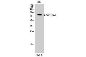 Western Blotting (WB) image for anti-V-Akt Murine Thymoma Viral Oncogene Homolog 1 (AKT1) (pThr72) antibody (ABIN3182569) (AKT1 抗体  (pThr72))