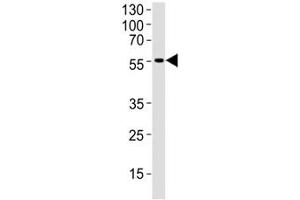 Western blot analysis of human brain tissue lysate using DCX antibody at 1:1000. (Doublecortin 抗体  (AA 107-137))