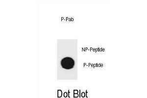 Dot blot analysis of mouse TSC1 Antibody (Phospho ) Phospho-specific Pab (ABIN1881911 and ABIN2839922) on nitrocellulose membrane. (TSC1 抗体  (pSer1130))