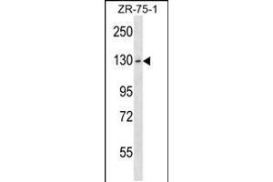 Western blot analysis in ZR-75-1 cell line lysates (35ug/lane). (HKDC1 抗体  (C-Term))