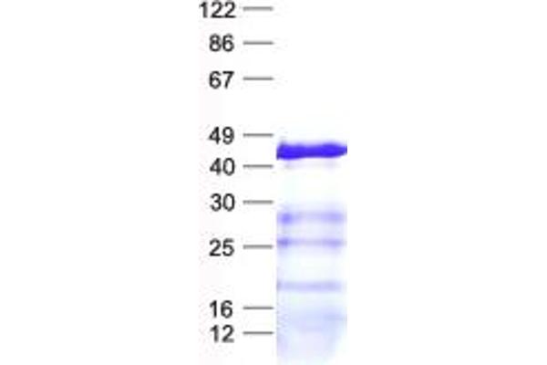 DHRS13 Protein (His tag)