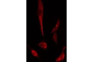ABIN6274965 staining  Hela cells by IF/ICC. (CBR3 抗体  (C-Term))
