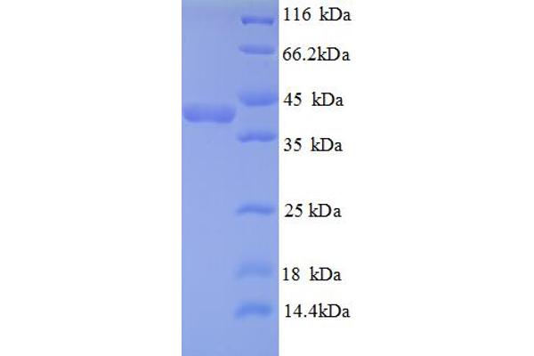 TXNDC17 Protein (AA 1-123, full length) (GST tag)