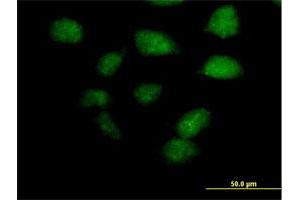 Immunofluorescence of purified MaxPab antibody to ZBTB32 on HeLa cell. (ZBTB32 抗体  (AA 1-302))