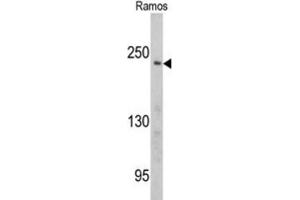 Western Blotting (WB) image for anti-Pericentriolar Material 1 (PCM1) antibody (ABIN3003242) (PCM1 抗体)