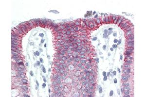 Immunohistochemistry (IHC) image for anti-Catenin (Cadherin-Associated Protein), beta 1, 88kDa (CTNNB1) (AA 758-771), (C-Term) antibody (ABIN364501)