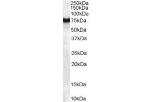 Western Blotting (WB) image for anti-Frizzled Family Receptor 8 (FZD8) (C-Term) antibody (ABIN2465732) (FZD8 抗体  (C-Term))