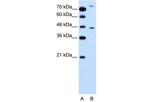 CCBP2 抗体  (N-Term)