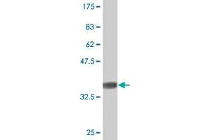 Western Blot detection against Immunogen (37. (Sorting Nexin 1 抗体  (AA 166-275))