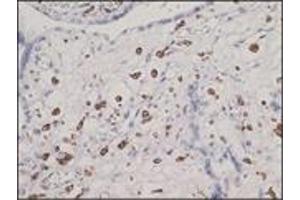 Immunohistochemistry (IHC) image for anti-CD163 (CD163) (N-Term) antibody (ABIN870405) (CD163 抗体  (N-Term))