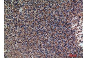 Immunohistochemistry (IHC) analysis of paraffin-embedded Human Brain, antibody was diluted at 1:200. (CD56 抗体)