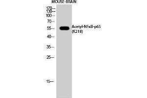 Western Blotting (WB) image for anti-Nuclear Factor-kB p65 (NFkBP65) (acLys218) antibody (ABIN3181891) (NF-kB p65 抗体  (acLys218))