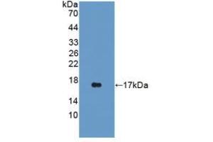 Western blot analysis of recombinant Rat iNV. (Involucrin 抗体  (AA 461-551))