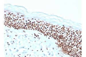 Immunohistochemistry (IHC) image for anti-Nucleophosmin (Nucleolar phosphoprotein B23, Numatrin) (NPM1) (AA 185-287) antibody (ABIN6940222)