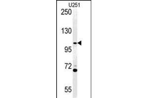 Western blot analysis of AC Antibody (N-term) (ABIN651370 and ABIN2840207) in  cell line lysates (35 μg/lane). (Acap3 抗体  (N-Term))