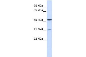 WB Suggested Anti-TMPRSS11D Antibody Titration:  1 ug/ml  Positive Control:  293T cells lysate (TMPRSS11D 抗体  (Middle Region))