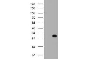 Image no. 1 for anti-B-Cell CLL/lymphoma 10 (BCL10) antibody (ABIN1496851) (BCL10 抗体)