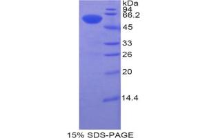 SDS-PAGE analysis of Human Btk Protein. (BTK 蛋白)