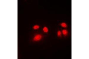 Immunofluorescent analysis of CBFB staining in Jurkat cells. (CBFB 抗体  (N-Term))
