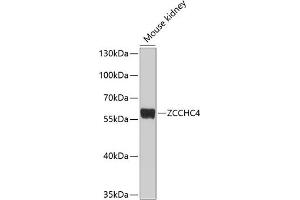 Western blot analysis of extracts of mouse kidney, using ZCCHC4 antibody (ABIN6133077, ABIN6150408, ABIN6150409 and ABIN6214292) at 1:1000 dilution. (ZCCHC4 抗体  (AA 50-220))
