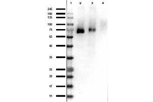 Western Blot Results of Rabbit Anti-RONpY1353 Antibody. (MST1R 抗体  (Internal Region, pTyr1353))