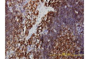 Immunohistochemistry (Formalin-fixed Paraffin-embedded Sections) (IHC (fp)) image for anti-Protein Kinase, Interferon-Inducible Double Stranded RNA Dependent Activator (PRKRA) (AA 1-313) antibody (ABIN563706)