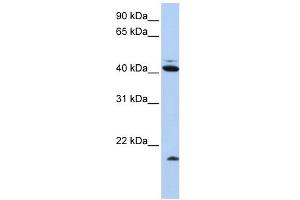 Ubiquitin D antibody used at 1 ug/ml to detect target protein. (UBD 抗体  (N-Term))