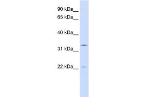 WB Suggested Anti-INMT Antibody Titration:  0. (INMT 抗体  (N-Term))
