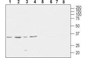 Western blot analysis of rat brain (lanes 1 and 5), mouse brain (lanes 2 and 6), human SH-SY5Y brain neuroblastoma (lanes 3 and 7) and  rat PC12 pheochromocytoma adrenal gland (lanes 4 and 8) lysates: - 1-4. (CACNG4 抗体  (C-Term, Intracellular))