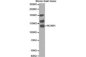 Western Blotting (WB) image for anti-Neural Cell Adhesion Molecule 1 (NCAM1) antibody (ABIN1679098) (CD56 抗体)