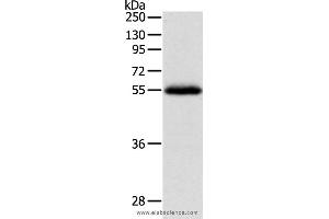 Western blot analysis of Human leiomyosarcoma tissue, using NPY1R Polyclonal Antibody at dilution of 1:400 (NPY1R 抗体)