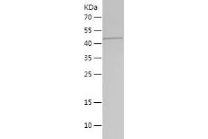 ARPC1B Protein (AA 175-372) (His-IF2DI Tag)