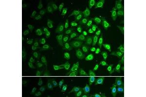 Immunofluorescence analysis of A549 cells using FAH Polyclonal Antibody (FAH 抗体)