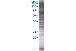 Western Blotting (WB) image for MTMR3 293T Cell Transient Overexpression Lysate(Denatured) (ABIN1334321)