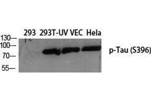 Western Blot (WB) analysis of specific cells using Phospho-Tau (S396) Polyclonal Antibody. (tau 抗体  (pSer396))