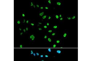 Immunofluorescence analysis of A549 cells using PAX2 Polyclonal Antibody (PAX2A 抗体)