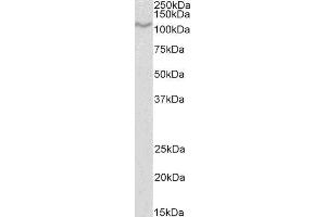 ABIN4902572 (1µg/ml) staining of U937 lysate (35µg protein in RIPA buffer). (CD68 抗体)