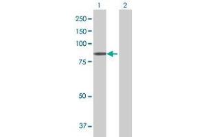 Western Blotting (WB) image for PLOD3 293T Cell Transient Overexpression Lysate(Denatured) (ABIN1334347)