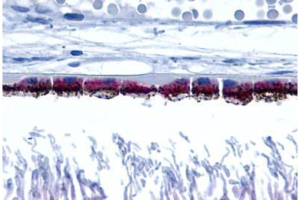 Peropsin 抗体  (Cytoplasmic Domain)