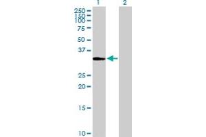 Western Blot analysis of ITPK1 expression in transfected 293T cell line by ITPK1 MaxPab polyclonal antibody. (ITPK1 抗体  (AA 1-314))