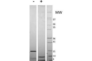 SDS-PAGE (SDS) image for Resistin Dimer protein (ABIN6700464)