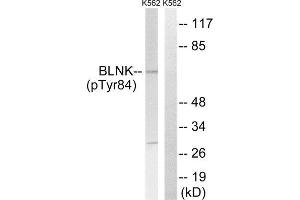 Western Blotting (WB) image for anti-B-Cell Linker (BLNK) (pTyr84) antibody (ABIN1847670) (B-Cell Linker 抗体  (pTyr84))